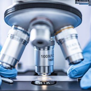 Detecció de l’Alzheimer buscant la proteïna tau en una anàlisi de sang
