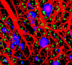 Un estudi geomètric de les cèl·lules del cervell podria canviar les estratègies contra l’Alzheimer