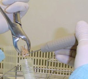 Obtenen per primer cop material genètic antic del bacteri de la càries