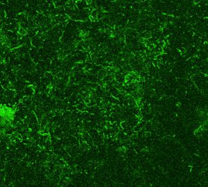 Descobreixen una molècula que inhibeix la replicació de l’ADN dels bacteris