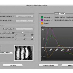 Software  CVC i Hospital Sant Pau