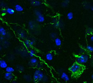 La UAB, pionera en l’estudi de la memòria amb optogenètica
