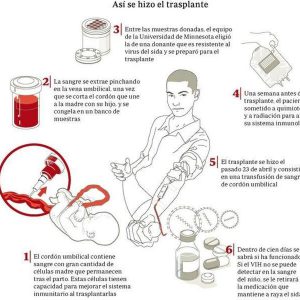 Primer trasplantament de sang de cordó per intentar curar la sida